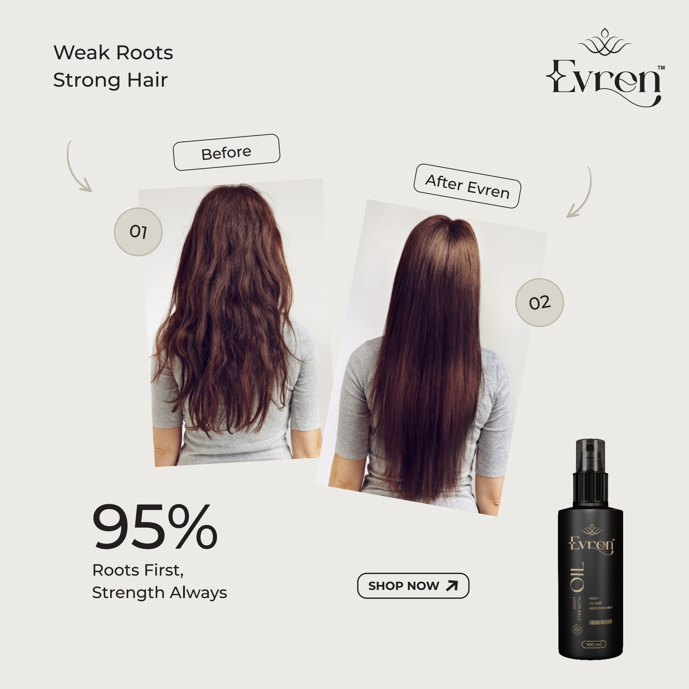 Anti-Hairfall Root Oil