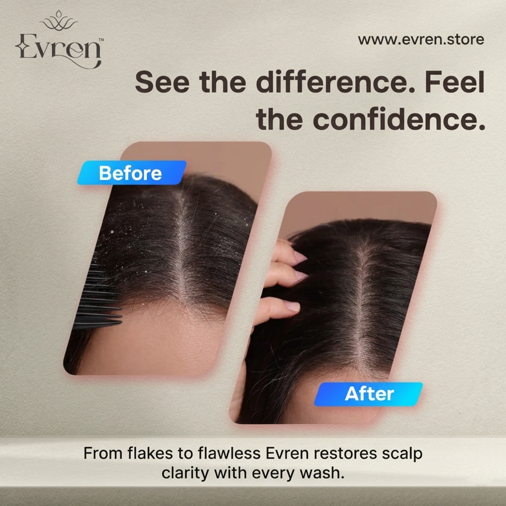 Before and after comparison of scalp with Evren hair product