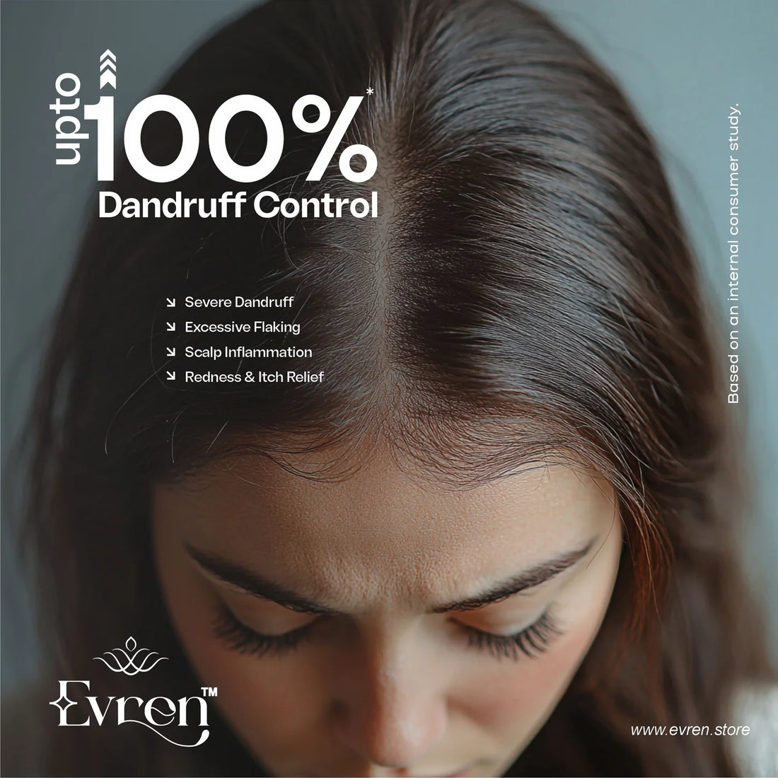 100% dandruff control kit from evren