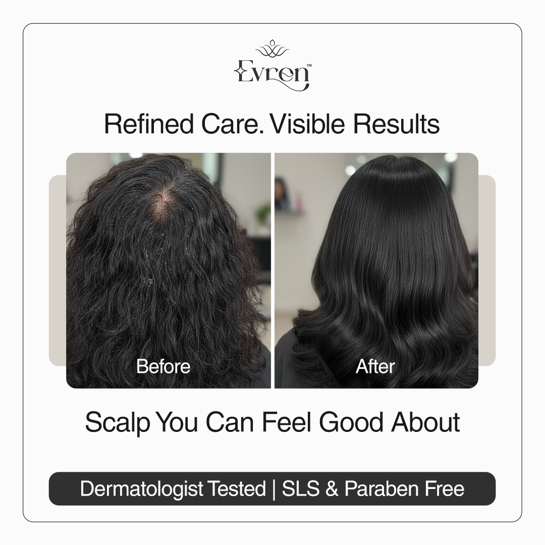 Result of Evren Anti-Dandruff Hair Oil
