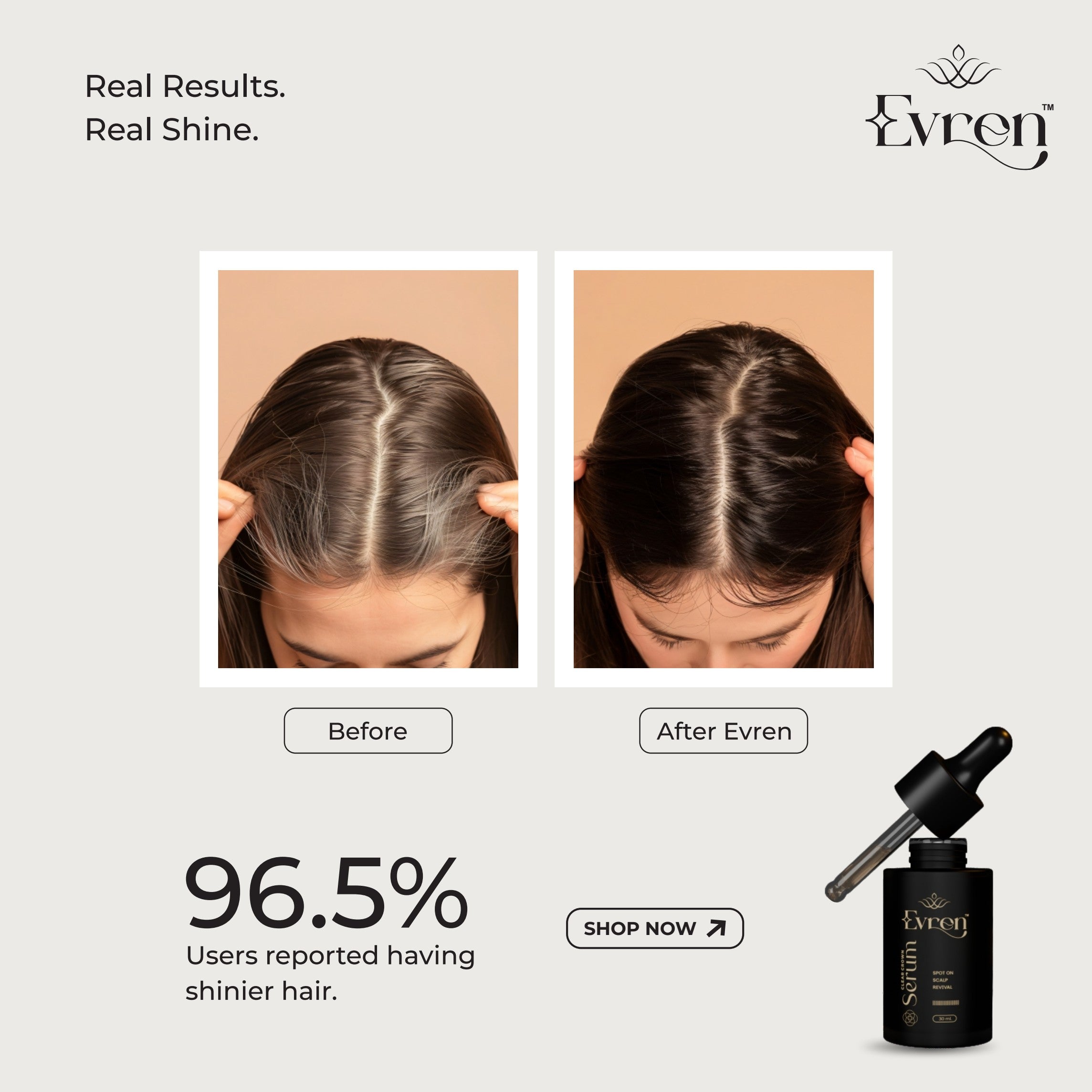 Applying Evren Anti-Dandruff Hair Serum directly to the scalp between hair washes