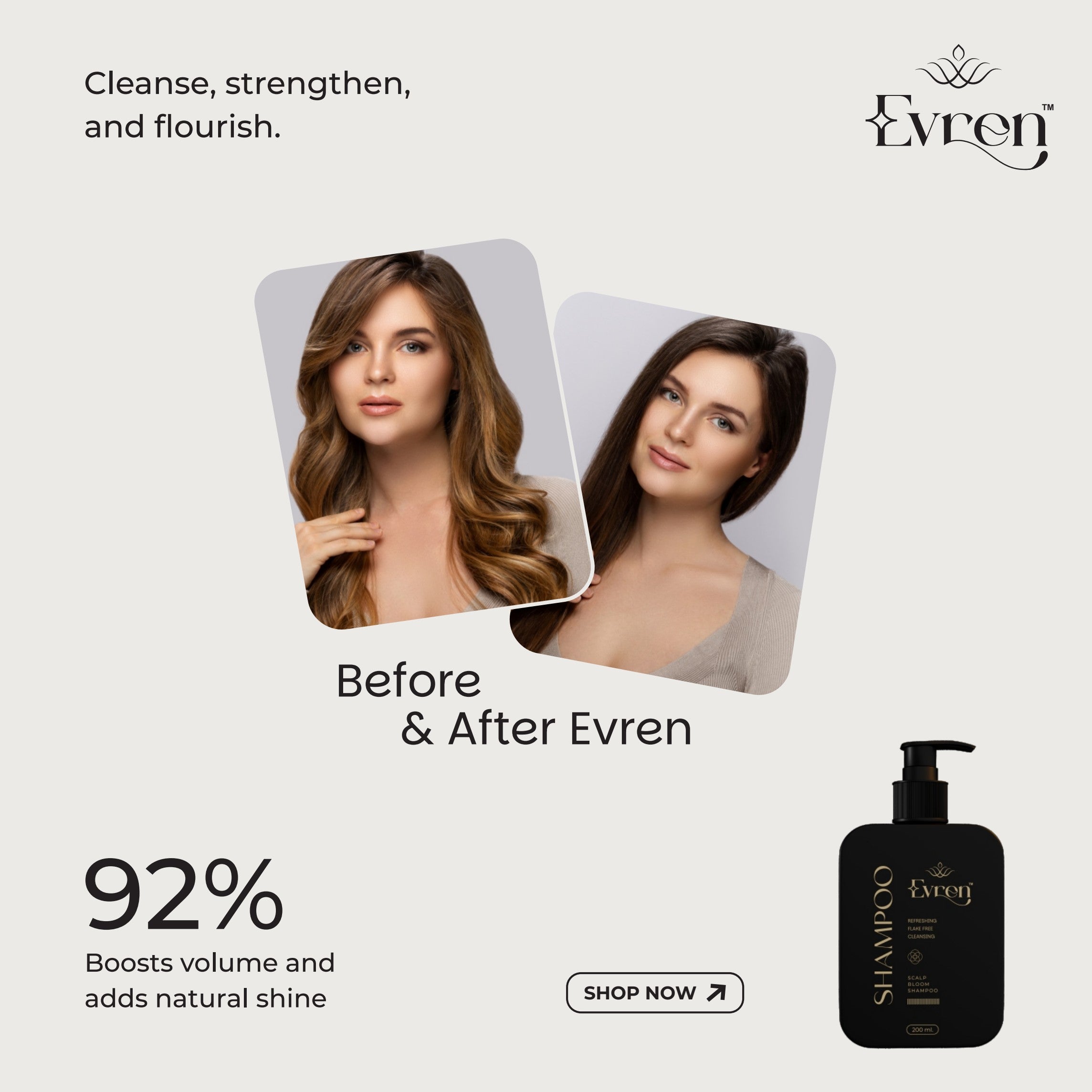 Before using Evren Anti-Dandruff Shampoo — flaky, dry scalp with visible dandruff