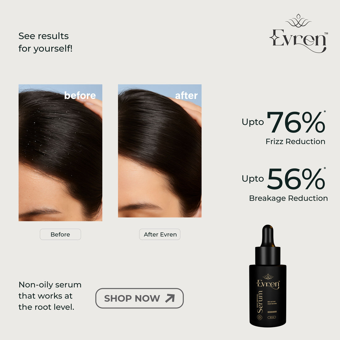 Lightweight Niacinamide texture of Evren Anti-Hairfall Hair Serum, absorbing without residue