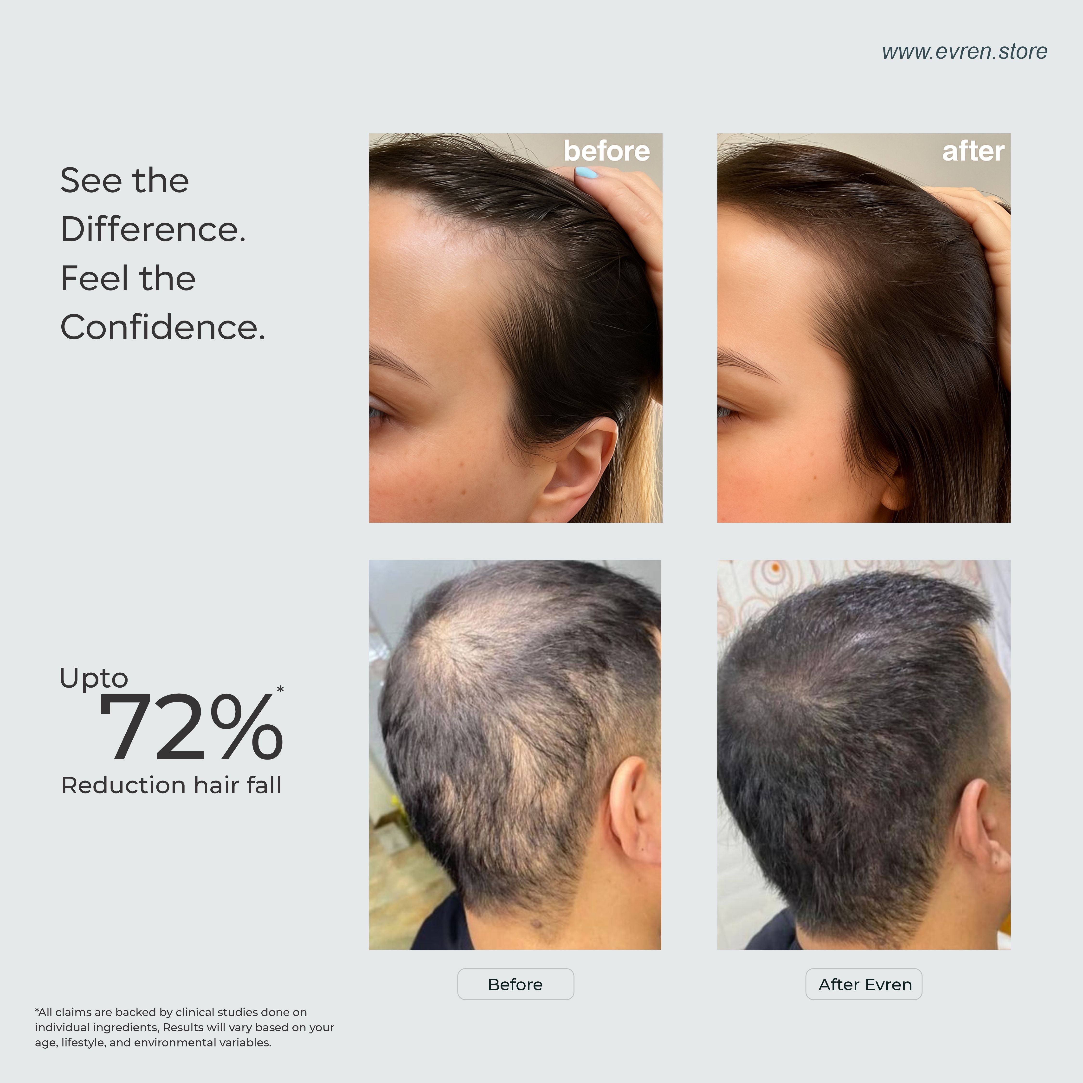 Real customer reviews of using evren hairfall combos up to 72% reduction hair fall